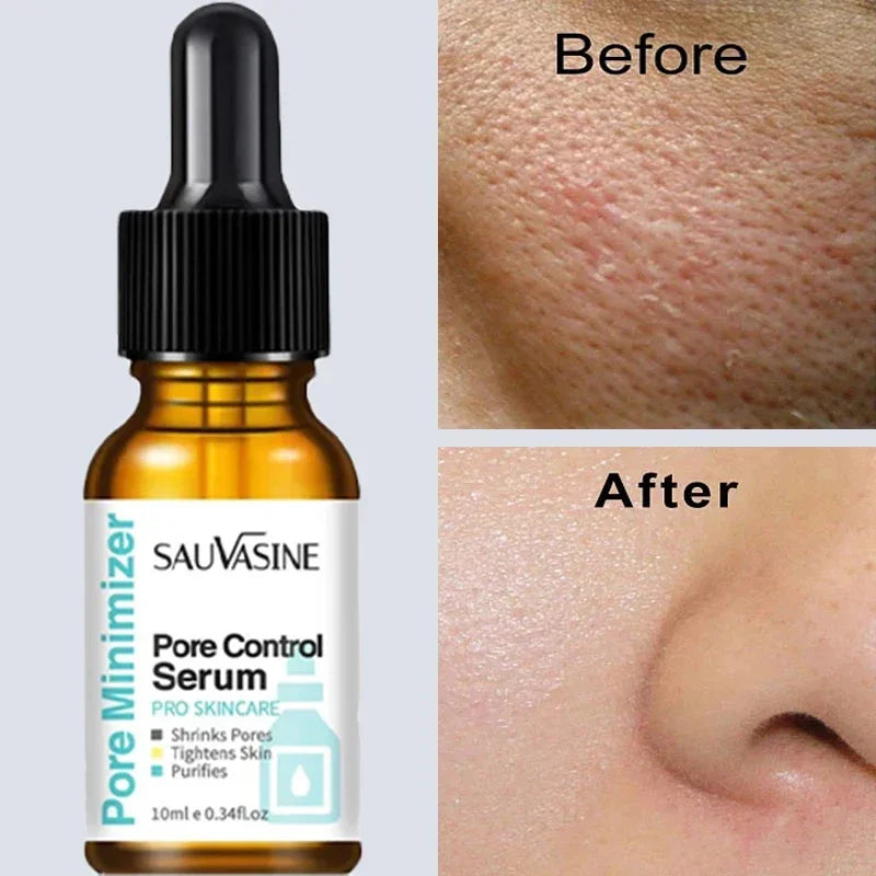 Pore Minimising Essence Refining Skin Reducing Pores Preventing Enlarged Pores Repairing Facial Skin Moisturising Skin Care