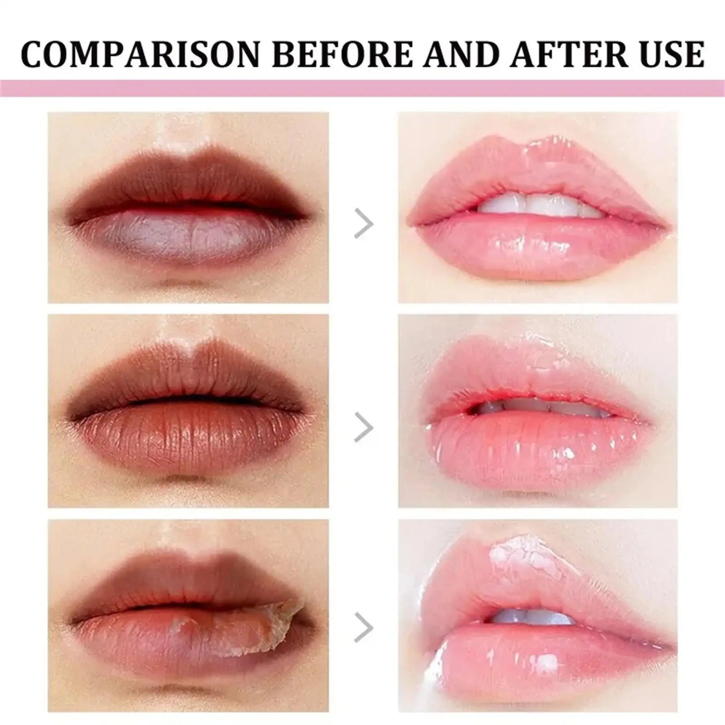 Remove Dark Lip Balm Lightening Melanin Mask Gloss Oil Exfoliating Clean Moisturizer Korean Care Products Makeup Beauty Health